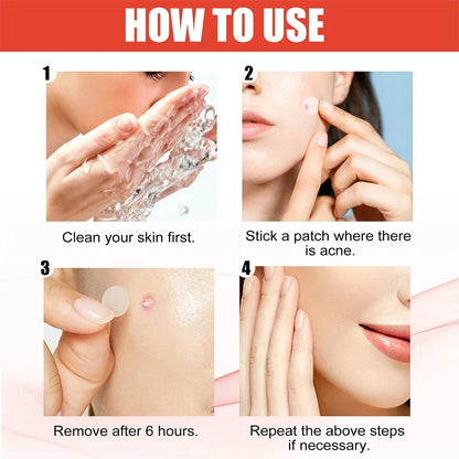 144 Adesivos Invisíveis para Acne Facial, Adesivos Anti-inflamatórios para Cuidados com a Pele, Adesivos Absorventes para Cobrir Acne
