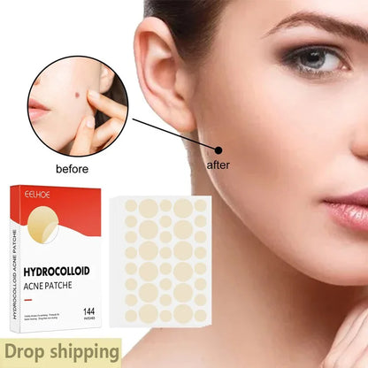 144 Adesivos Invisíveis para Acne Facial, Adesivos Anti-inflamatórios para Cuidados com a Pele, Adesivos Absorventes para Cobrir Acne