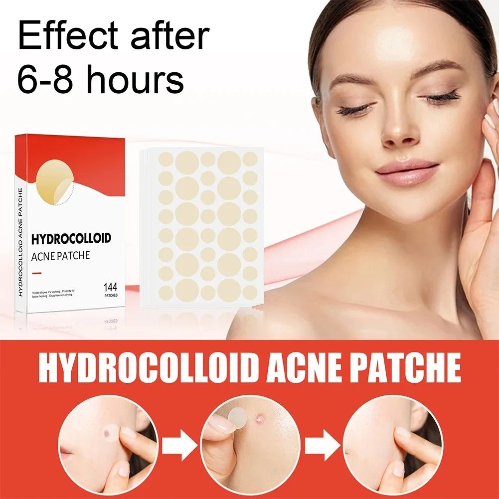 144 Adesivos Invisíveis para Acne Facial, Adesivos Anti-inflamatórios para Cuidados com a Pele, Adesivos Absorventes para Cobrir Acne